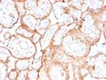 Aurora B (Proliferation Marker) Antibody in Immunohistochemistry (Paraffin) (IHC (P))