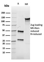 Aurora B (Proliferation Marker) Antibody in SDS-PAGE (SDS-PAGE)