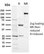 Aurora B Antibody in SDS-PAGE (SDS-PAGE)