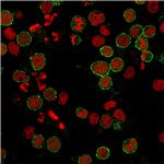 CD6 Antibody in Immunocytochemistry (ICC/IF)