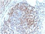 CD6 Antibody in Immunohistochemistry (Paraffin) (IHC (P))