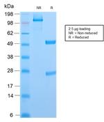 CD6 Antibody in SDS-PAGE (SDS-PAGE)
