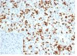 CD6 (Negative Marker of T-regulatory Cells) Antibody in Immunohistochemistry (Paraffin) (IHC (P))