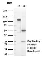 CD6 (Negative Marker of T-regulatory Cells) Antibody in SDS-PAGE (SDS-PAGE)