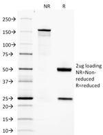 Adiponectin Antibody in SDS-PAGE (SDS-PAGE)