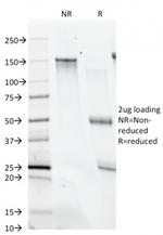 CD28 Antibody in SDS-PAGE (SDS-PAGE)