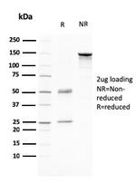 CD80 (B7-1) Antibody in SDS-PAGE (SDS-PAGE)
