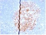 CD86 (Dendritic Cells Maturation Marker) Antibody in Immunohistochemistry (Paraffin) (IHC (P))