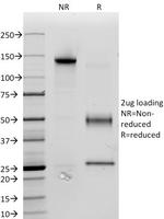 CD34 (Hematopoietic Stem Cell and Endothelial Marker) Antibody in SDS-PAGE (SDS-PAGE)