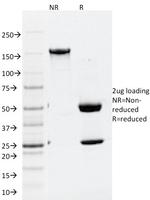 ATG5 Antibody in SDS-PAGE (SDS-PAGE)