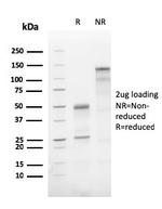 ATG5 (Autophagy Marker) Antibody in Immunoelectrophoresis (IE)