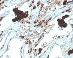 Napsin A (Lung Adenocarcinoma Marker) Antibody in Immunohistochemistry (Paraffin) (IHC (P))