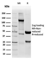 Napsin A (Lung Adenocarcinoma Marker) Antibody in SDS-PAGE (SDS-PAGE)