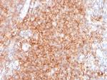 CD40/TNFRSF5/CD40L-Receptor Antibody in Immunohistochemistry (Paraffin) (IHC (P))