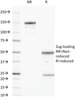 CD40/TNFRSF5/CD40L-Receptor Antibody in SDS-PAGE (SDS-PAGE)