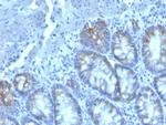 CD40 Ligand/CD154/TRAP1 (Activation Marker of T-Lymphocytes) Antibody in Immunohistochemistry (Paraffin) (IHC (P))