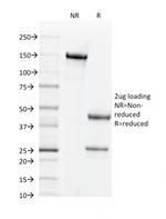 CD44v6 (Marker of Tumor Metastasis) Antibody in SDS-PAGE (SDS-PAGE)