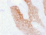 CD44v6 (Marker of Tumor Metastasis) Antibody in Immunohistochemistry (Paraffin) (IHC (P))
