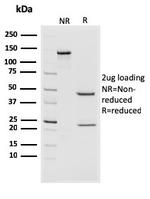 CD44v4/5 (Marker of Tumor Metastasis) Antibody in SDS-PAGE (SDS-PAGE)