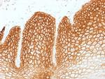 CD44v6 Antibody in Immunohistochemistry (Paraffin) (IHC (P))