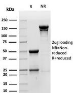 CD44v6 Antibody in SDS-PAGE (SDS-PAGE)