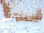 KLK4/Kallikrein related peptidase 4 Antibody in Immunohistochemistry (Paraffin) (IHC (P))