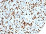 CD59/Complement Regulatory Protein/Protectin Antibody in Immunohistochemistry (Paraffin) (IHC (P))