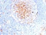 CD59/Complement Regulatory Protein/Protectin Antibody in Immunohistochemistry (Paraffin) (IHC (P))