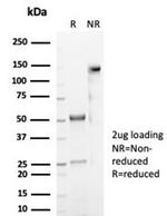 CD59/Complement Regulatory Protein/Protectin Antibody in SDS-PAGE (SDS-PAGE)