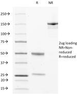 CD63 (Late Endosomes Marker) Antibody in SDS-PAGE (SDS-PAGE)