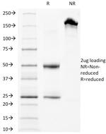 CD63 (Late Endosomes Marker) Antibody in SDS-PAGE (SDS-PAGE)