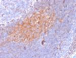 CD81/TAPA-1 Antibody in Immunohistochemistry (Paraffin) (IHC (P))