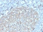 CD81/TAPA-1 Antibody in Immunohistochemistry (Paraffin) (IHC (P))