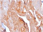 CD81/TAPA-1 Antibody in Immunohistochemistry (Paraffin) (IHC (P))