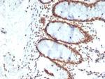 CDC5L Antibody in Immunohistochemistry (Paraffin) (IHC (P))