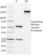 Cdc20 (Cell Division Cycle Protein 20) Antibody in SDS-PAGE (SDS-PAGE)