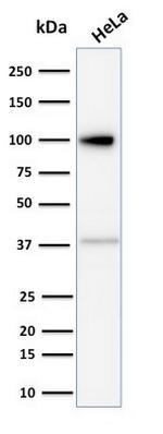 Major Vault Protein (MVP) Antibody in Western Blot (WB)