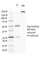 TNFS15/VEGI (Vascular Endothelial Growth Inhibitor) Antibody in SDS-PAGE (SDS-PAGE)