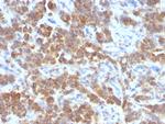 TNFS15/VEGI (Vascular Endothelial Growth Inhibitor) Antibody in Immunohistochemistry (Paraffin) (IHC (P))