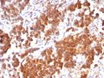 TNFS15/VEGI (Vascular Endothelial Growth Inhibitor) Antibody in Immunohistochemistry (Paraffin) (IHC (P))