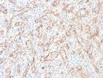 TNFS15/VEGI (Vascular Endothelial Growth Inhibitor) Antibody in Immunohistochemistry (Paraffin) (IHC (P))