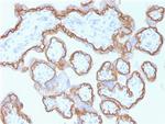 E-Cadherin (CDH1)/CD324 (Intercellular Junction Marker) Antibody in Immunohistochemistry (Paraffin) (IHC (P))