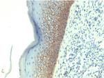 E-Cadherin (CDH1)/CD324 (Intercellular Junction Marker) Antibody in Immunohistochemistry (Paraffin) (IHC (P))