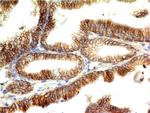 E-Cadherin (CDH1)/CD324 (Intercellular Junction Marker) Antibody in Immunohistochemistry (Paraffin) (IHC (P))