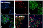 Rabbit IgG (H+L) Cross-Adsorbed Secondary Antibody in Immunocytochemistry (ICC/IF)