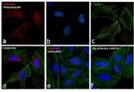 Mouse IgG (H+L) Cross-Adsorbed Secondary Antibody in Immunocytochemistry (ICC/IF)