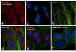 Mouse IgG (H+L) Cross-Adsorbed Secondary Antibody in Immunocytochemistry (ICC/IF)