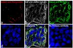 Rabbit IgG (H+L) Cross-Adsorbed Secondary Antibody in Immunocytochemistry (ICC/IF)