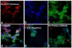 Mouse IgG (H+L) Cross-Adsorbed Secondary Antibody in Immunocytochemistry (ICC/IF)