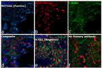 Rabbit IgG (H+L) Highly Cross-Adsorbed Secondary Antibody in Immunocytochemistry (ICC/IF)